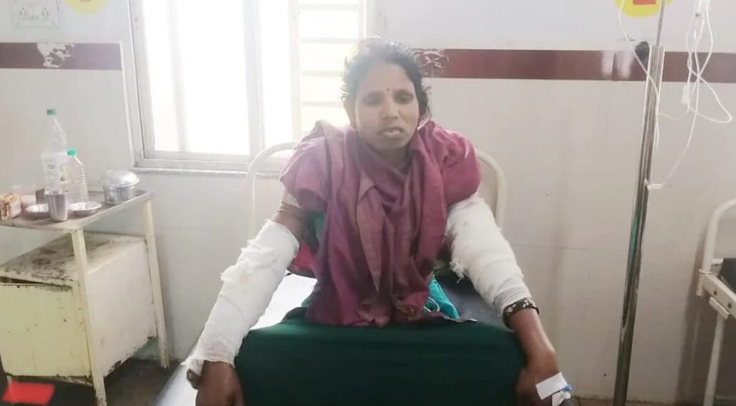 नशेड़ी पति की दरिंदगी, पत्नी पर हमला कर काटे दोनों हाथ  - Panchayati Times